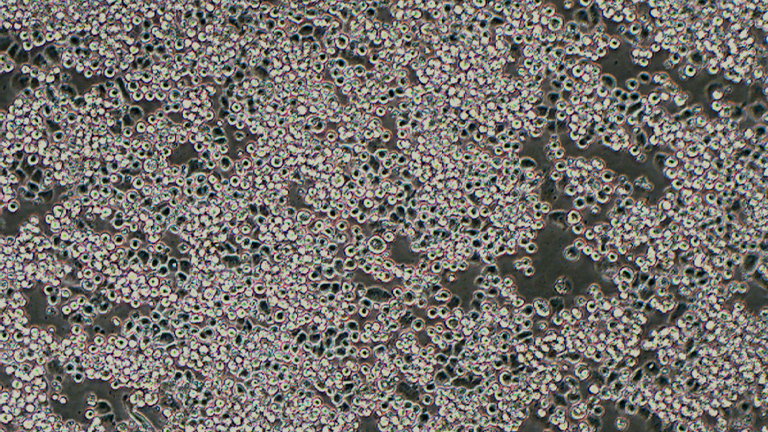MDA-MB-453人乳腺癌細胞（STR鑒定正確）