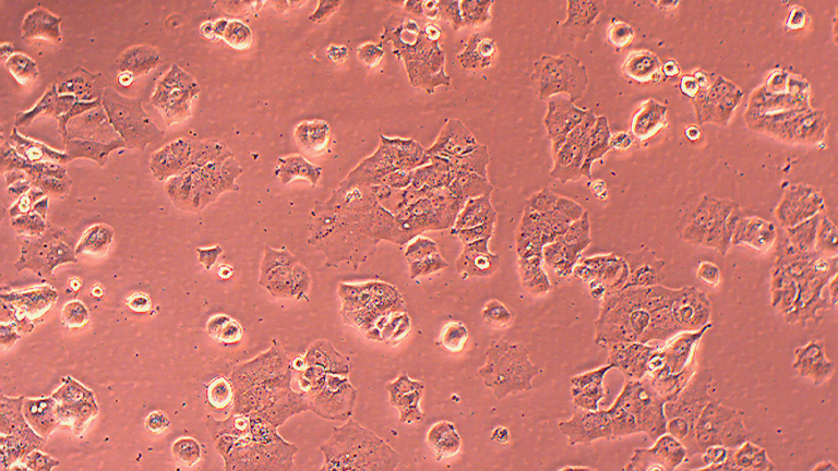 ZR-75-30人乳腺導管癌細胞（STR鑒定正確）