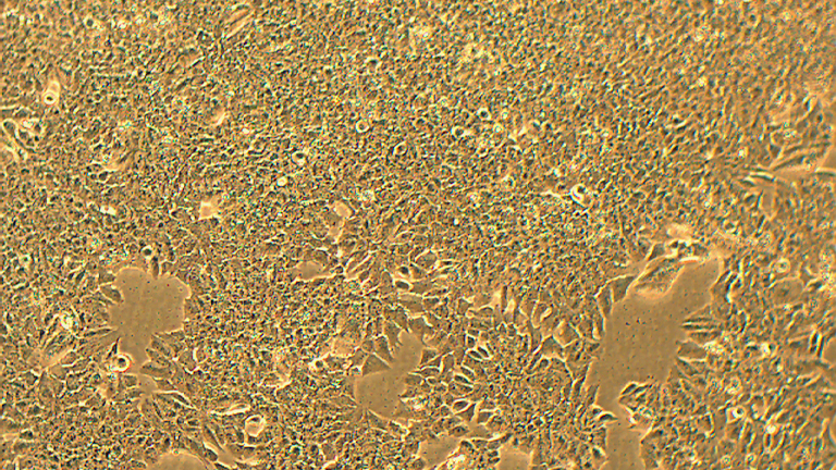 MDA-MB-361人乳腺癌細胞（STR鑒定正確）