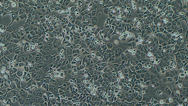HEC-1-A人子宮內膜腺癌細胞（STR鑒定正確）