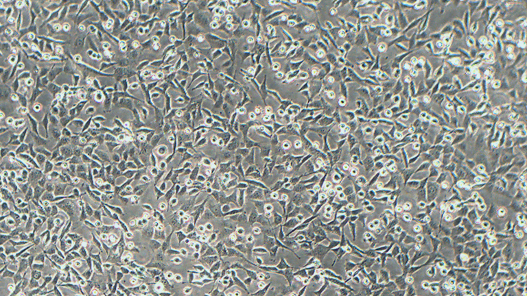 HCEC-B4G12人角膜內(nèi)皮細(xì)胞（STR鑒定正確）