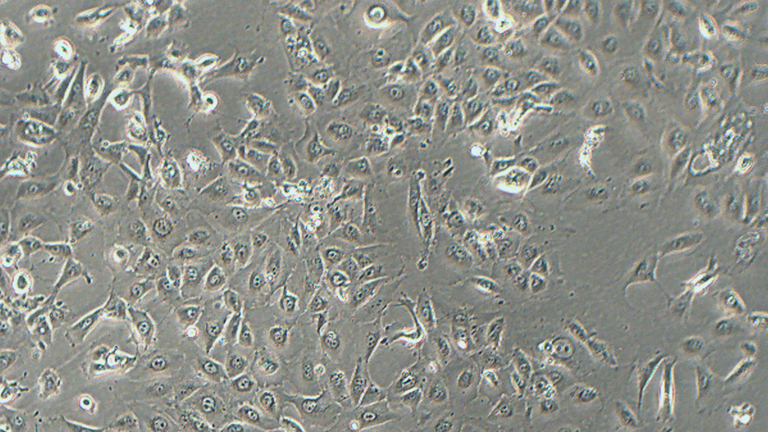NCI-H226人間皮瘤細胞（STR鑒定正確）