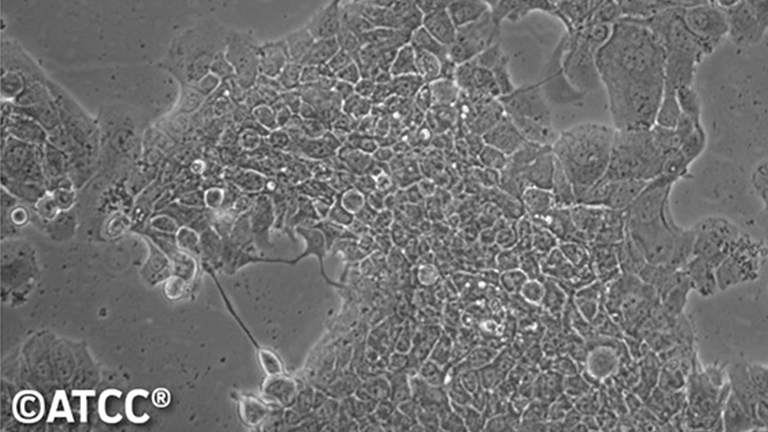 MDA-MB-415人乳腺腺癌細胞（STR鑒定正確）