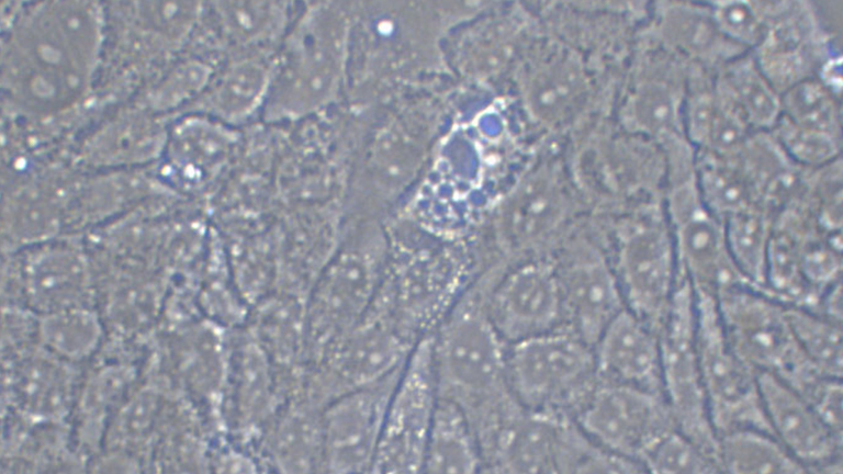 SW1116人結(jié)腸腺癌細胞（STR鑒定正確）