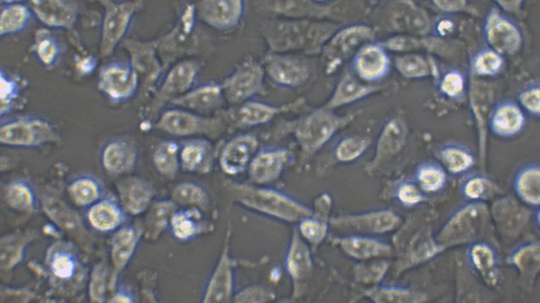 CAL-62人甲狀腺癌細(xì)胞（退行性）（STR鑒定正確）