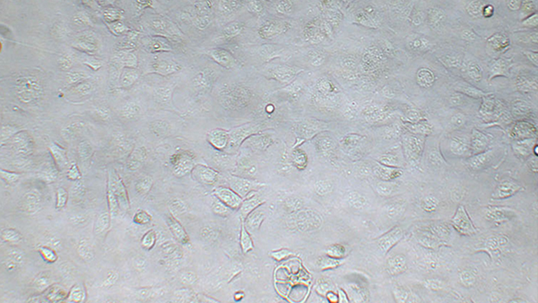 NCI-H661人大細胞肺癌細胞（STR鑒定正確）