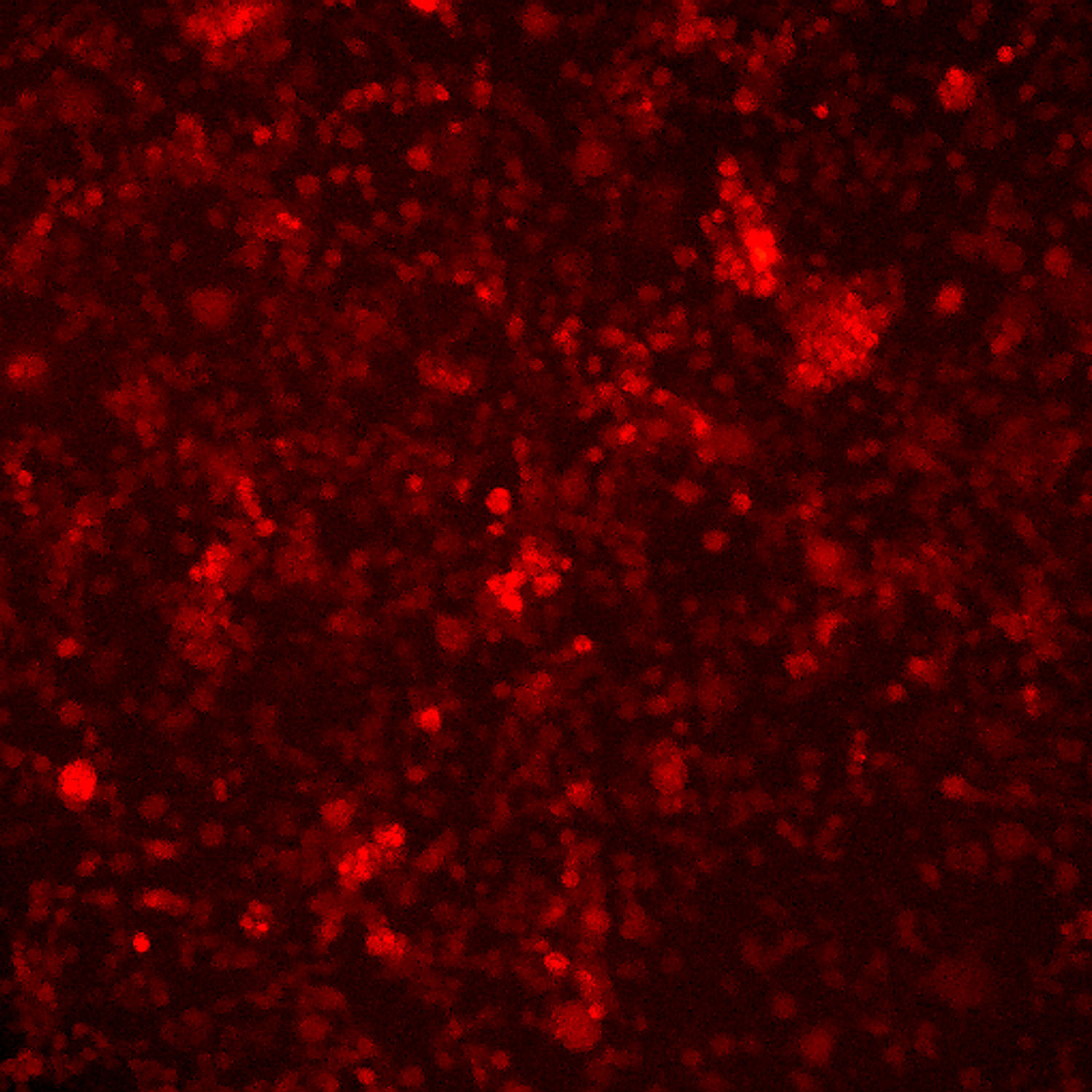 NEURO-2A-RFP