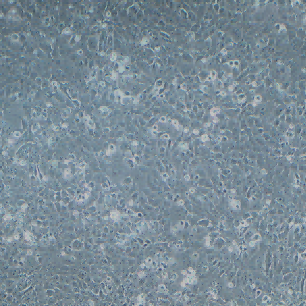 4T1小鼠乳腺癌細(xì)胞（STR鑒定正確）
