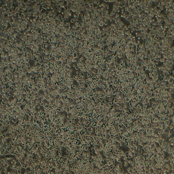 LLC-LUC(STR)示蹤穩(wěn)定細胞株（STR鑒定正確）