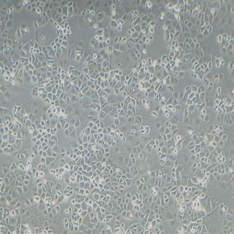 HEC-1-B人子宮內膜腺癌細胞（STR鑒定正確）