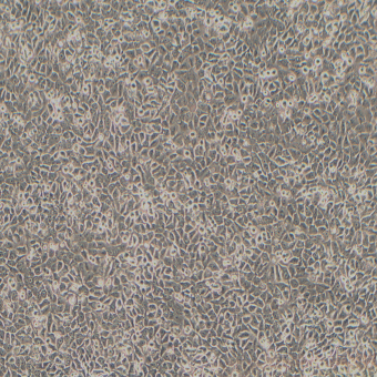 NCI-H292人肺粘液上皮樣癌細(xì)胞（STR鑒定正確）