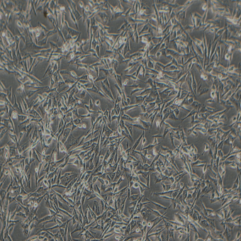NCI-H1975人非小細胞肺腺癌細胞（STR鑒定正確）