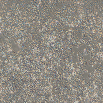 NCI-H520人肺鱗癌細胞（STR鑒定正確）