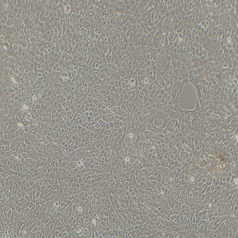 HCC827人非小細胞肺癌細胞（STR鑒定正確）