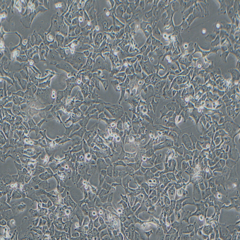HCC4006人肺癌腺癌細胞（STR鑒定正確）