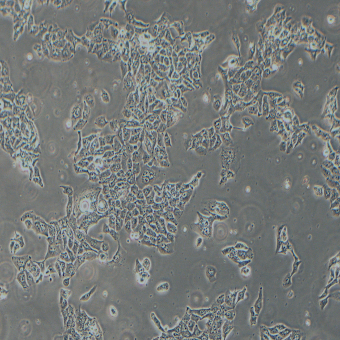 NCI-H441人肺腺癌細(xì)胞（STR鑒定正確）