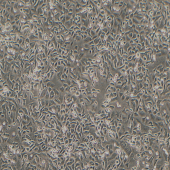 NCI-H2122人肺腺癌細(xì)胞（STR鑒定正確）