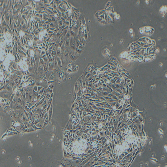 NCI-H2347人非小細胞肺癌細胞（STR鑒定正確）