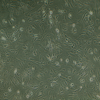SW1088人腦星形膠質(zhì)細(xì)胞瘤細(xì)胞（STR鑒定正確）