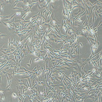 SW1783人腦星形膠質細胞瘤細胞（STR鑒定正確）