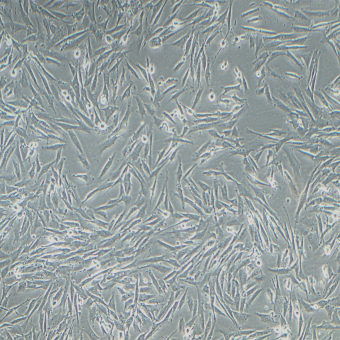 HS683人腦膠質瘤細胞（STR鑒定正確）
