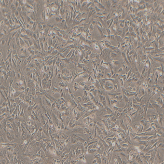 TJ905人膠質(zhì)瘤細胞（STR鑒定正確）