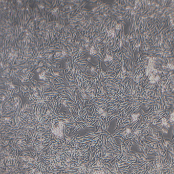 Mel270人脈絡(luò)膜黑色素瘤細胞（STR鑒定正確）