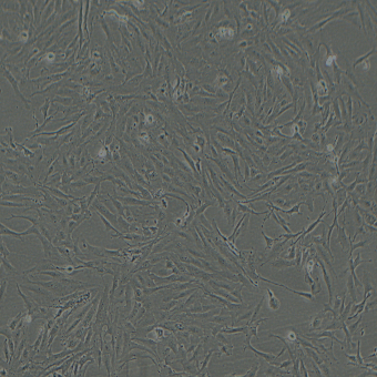 SW1353人骨肉瘤細(xì)胞（STR鑒定正確）