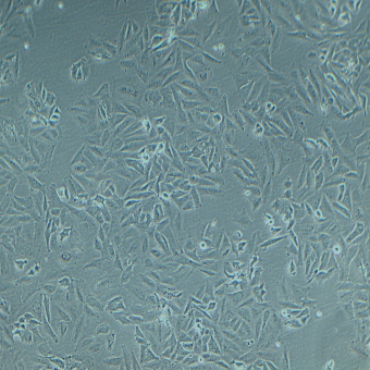 SAOS-2人成骨肉瘤細(xì)胞（STR鑒定正確）