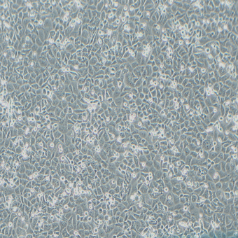 NCI-H522人肺腺癌細(xì)胞（STR鑒定正確）