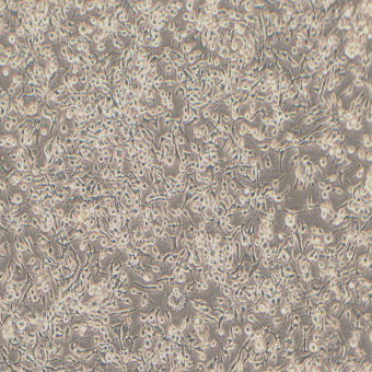 MDA-MB-436人乳腺腺癌細胞（STR鑒定正確）
