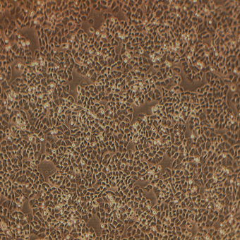 MDA-MB-468人乳腺癌細胞（STR鑒定正確）