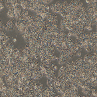 ZR-75-1人乳腺導管癌細胞（STR鑒定正確）