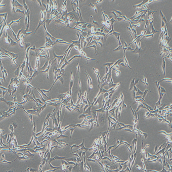 HCC38人乳腺導管癌細胞（STR鑒定正確）