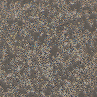 HCC1806人乳腺癌細胞（STR鑒定正確）