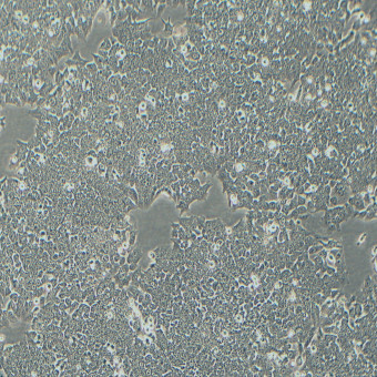 HCT-116人結(jié)直腸腺癌細胞（STR鑒定正確）