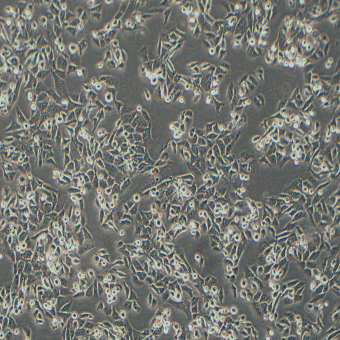 SK-HEP-1人肝腹水腺癌細(xì)胞（STR鑒定正確）