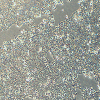 NCI-H1573人非小細胞肺腺癌細胞（STR鑒定正確）
