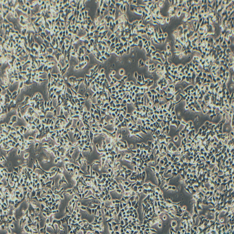 NCI-H3122人肺腺癌細(xì)胞（STR鑒定正確）