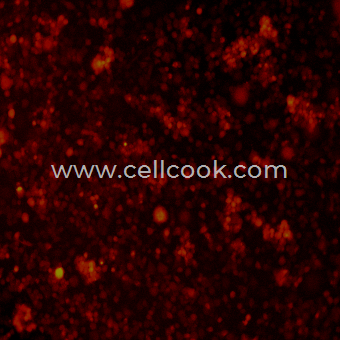 NEURO-2A-RFP